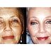 10 Amazing Cosmetic Transformations You Have to See to Believe