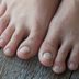 6 Causes of Yellow Toenails and Treatments That Help