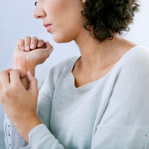 woman itching her wrist